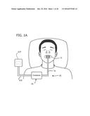 LIQUID CONTAINER AND ABSORBENT INSERT FOR ORAL NEGATIVE-PRESSURE THERAPY     SYSTEM diagram and image