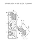 APPARATUSES AND METHODS FOR NEGATIVE PRESSURE WOUND THERAPY diagram and image