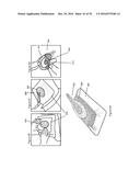 APPARATUSES AND METHODS FOR NEGATIVE PRESSURE WOUND THERAPY diagram and image