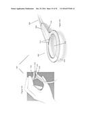 APPARATUSES AND METHODS FOR NEGATIVE PRESSURE WOUND THERAPY diagram and image