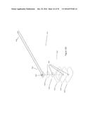 APPARATUSES AND METHODS FOR NEGATIVE PRESSURE WOUND THERAPY diagram and image