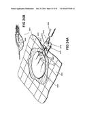 APPARATUSES AND METHODS FOR NEGATIVE PRESSURE WOUND THERAPY diagram and image