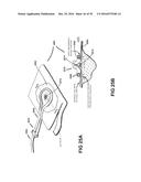 APPARATUSES AND METHODS FOR NEGATIVE PRESSURE WOUND THERAPY diagram and image