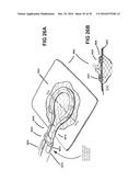 APPARATUSES AND METHODS FOR NEGATIVE PRESSURE WOUND THERAPY diagram and image