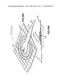 APPARATUSES AND METHODS FOR NEGATIVE PRESSURE WOUND THERAPY diagram and image