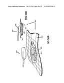 APPARATUSES AND METHODS FOR NEGATIVE PRESSURE WOUND THERAPY diagram and image