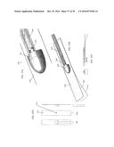 APPARATUSES AND METHODS FOR NEGATIVE PRESSURE WOUND THERAPY diagram and image