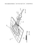 APPARATUSES AND METHODS FOR NEGATIVE PRESSURE WOUND THERAPY diagram and image