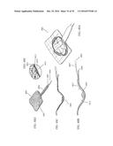 APPARATUSES AND METHODS FOR NEGATIVE PRESSURE WOUND THERAPY diagram and image