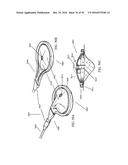 APPARATUSES AND METHODS FOR NEGATIVE PRESSURE WOUND THERAPY diagram and image