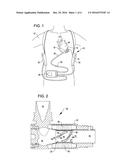 VENTRICULAR ASSIST DEVICES HAVING A HOLLOW ROTOR AND METHODS OF USE diagram and image