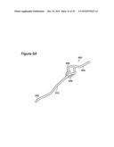 VESSEL CANNULATION DEVICE AND METHOD OF USE diagram and image