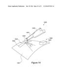 VESSEL CANNULATION DEVICE AND METHOD OF USE diagram and image