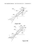 VESSEL CANNULATION DEVICE AND METHOD OF USE diagram and image