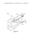 VESSEL CANNULATION DEVICE AND METHOD OF USE diagram and image