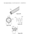 VESSEL CANNULATION DEVICE AND METHOD OF USE diagram and image