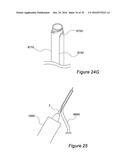 VESSEL CANNULATION DEVICE AND METHOD OF USE diagram and image