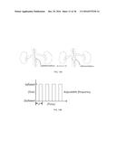 DEVICES AND METHODS FOR TREATING ACUTE KIDNEY INJURY diagram and image