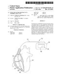 DETECTION OF DISLODGEMENT OF A DEFIBRILLATION LEAD diagram and image