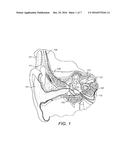 Selective Stimulation with Cochlear Implants diagram and image