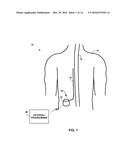 MEDICAL LEAD FASTENER INCLUDING INTEGRATED CLAMP diagram and image