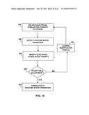 PROGRAMMING POSTURE RESPONSIVE THERAPY diagram and image