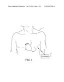 OPTIMIZED FLASH MEMORY DEVICE FOR MINIATURIZED DEVICES diagram and image