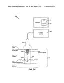 METHOD AND SYSTEM FOR ULTRASOUND TREATMENT OF SKIN diagram and image