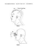 METHODS AND SYSTEMS FOR DETECTING HEALTH CONDITIONS BY IMAGING PORTIONS OF     THE EYE, INCLUDING THE FUNDUS diagram and image