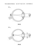 METHODS AND SYSTEMS FOR DETECTING HEALTH CONDITIONS BY IMAGING PORTIONS OF     THE EYE, INCLUDING THE FUNDUS diagram and image