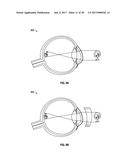 METHODS AND SYSTEMS FOR DETECTING HEALTH CONDITIONS BY IMAGING PORTIONS OF     THE EYE, INCLUDING THE FUNDUS diagram and image