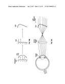 METHODS AND SYSTEMS FOR DETECTING HEALTH CONDITIONS BY IMAGING PORTIONS OF     THE EYE, INCLUDING THE FUNDUS diagram and image