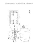 METHODS AND SYSTEMS FOR DETECTING HEALTH CONDITIONS BY IMAGING PORTIONS OF     THE EYE, INCLUDING THE FUNDUS diagram and image