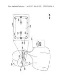 METHODS AND SYSTEMS FOR DETECTING HEALTH CONDITIONS BY IMAGING PORTIONS OF     THE EYE, INCLUDING THE FUNDUS diagram and image