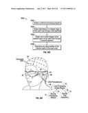 METHODS AND SYSTEMS FOR DETECTING HEALTH CONDITIONS BY IMAGING PORTIONS OF     THE EYE, INCLUDING THE FUNDUS diagram and image