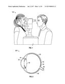 AUGMENTED AND VIRTUAL REALITY DISPLAY SYSTEMS AND METHODS FOR DETERMINING     OPTICAL PRESCRIPTIONS BY IMAGING RETINA diagram and image