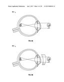 AUGMENTED AND VIRTUAL REALITY DISPLAY SYSTEMS AND METHODS FOR DETERMINING     OPTICAL PRESCRIPTIONS BY IMAGING RETINA diagram and image