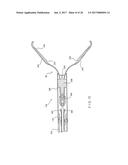 Through the Scope Tension Member Release Clip diagram and image