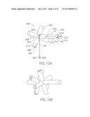 Implant System and Delivery Method diagram and image