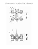 SPINOUS PROCESS FIXATION SYSTEM AND METHODS THEREOF diagram and image