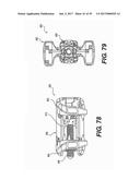 SPINOUS PROCESS FIXATION SYSTEM AND METHODS THEREOF diagram and image