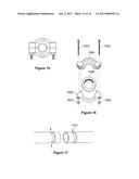 Safety Flow Obstruction Holder diagram and image