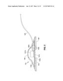 CAPSULE AND METHOD FOR TREATING OR DIAGNOSING CONDITIONS OR DISEASES OF     THE INTESTINAL TRACT diagram and image