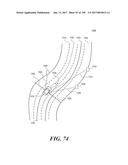 AUTONOMOUS VEHICLE TAIL ALIGNMENT NAVIGATION diagram and image