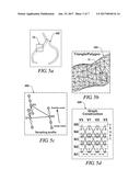 3-D VESSEL TREE SURFACE RECONSTRUCTION METHOD diagram and image