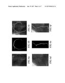 3-D VESSEL TREE SURFACE RECONSTRUCTION METHOD diagram and image