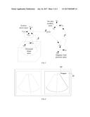 ULTRASOUND FUSION IMAGING METHOD AND ULTRASOUND FUSION IMAGING NAVIGATION     SYSTEM diagram and image