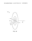 FISTULA TREATMENT DEVICES AND METHODS diagram and image