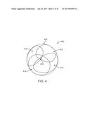 FISTULA TREATMENT DEVICES AND METHODS diagram and image