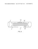 FISTULA TREATMENT DEVICES AND METHODS diagram and image